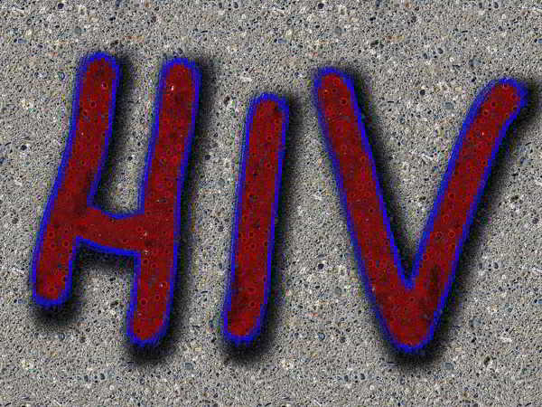 Biểu hiện, tác hại và cách phòng tránh bệnh HIV