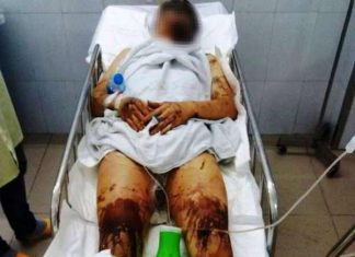 Anh trai nam Việt Kiều bị tạt axit cắt gân chân đã khóa số điện thoại sau khi về Canada