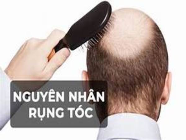  Nhiễm trùng và tình trạng da đầu