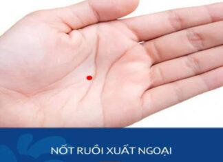 nốt ruồi xuất ngoại