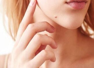 ý nghĩa nốt ruồi ở cằm phải nam nữ may mắn hay thử thách