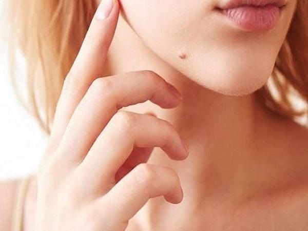 Nốt ruồi ở cằm phải nói lên điều gì?