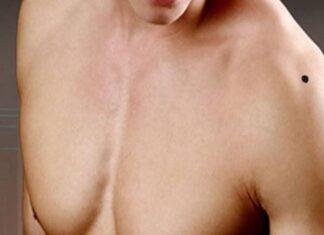 Xem tướng nốt ruồi ở bả vai trái và phải nam nữ đoán mệnh nốt ruồi bả vai